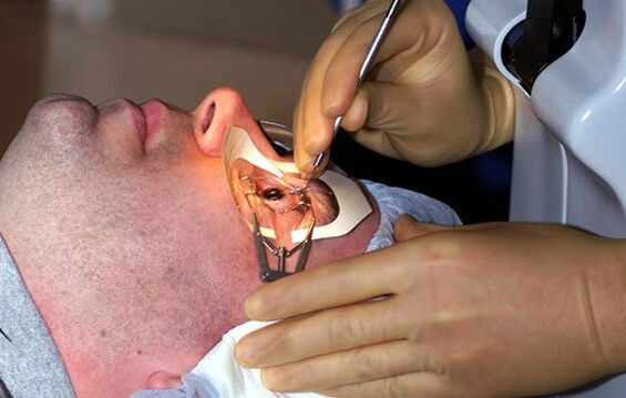Scleroplasty in case of myopia in order to stabilize vision
